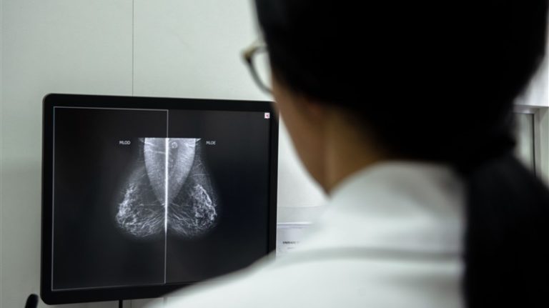 Agora é lei: Mulheres entre 49 e 60 anos têm prioridade em exame de mama