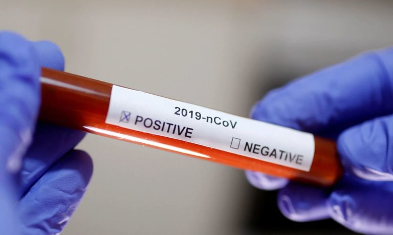Brasil ultrapassa marca de um milhão de casos confirmados do novo coronavírus