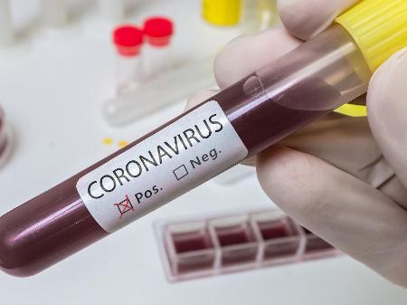 Boletim Coronavírus (29/11): 22.561 óbitos e 353.316 casos confirmados no RJ