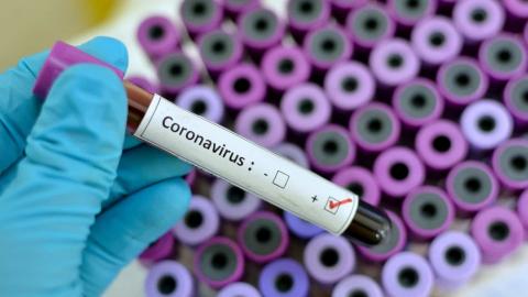 São Gonçalo registra mais cinco óbitos e chega a 610 mortes por coronavírus