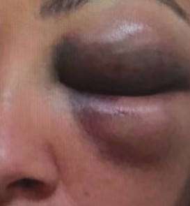 Lutador de artes marciais é preso por suspeita de agredir ex-namorada, em Niterói
