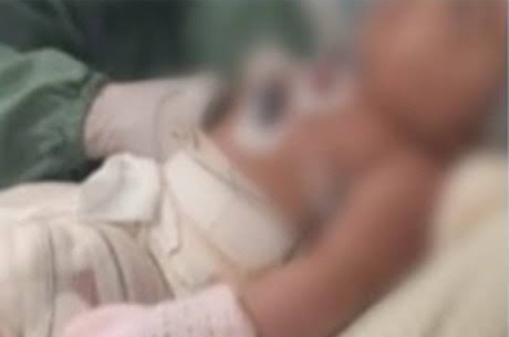 Enfermeiras são indicadas por morte de bebê que teve e o corpo queimado em hospital de Niterói