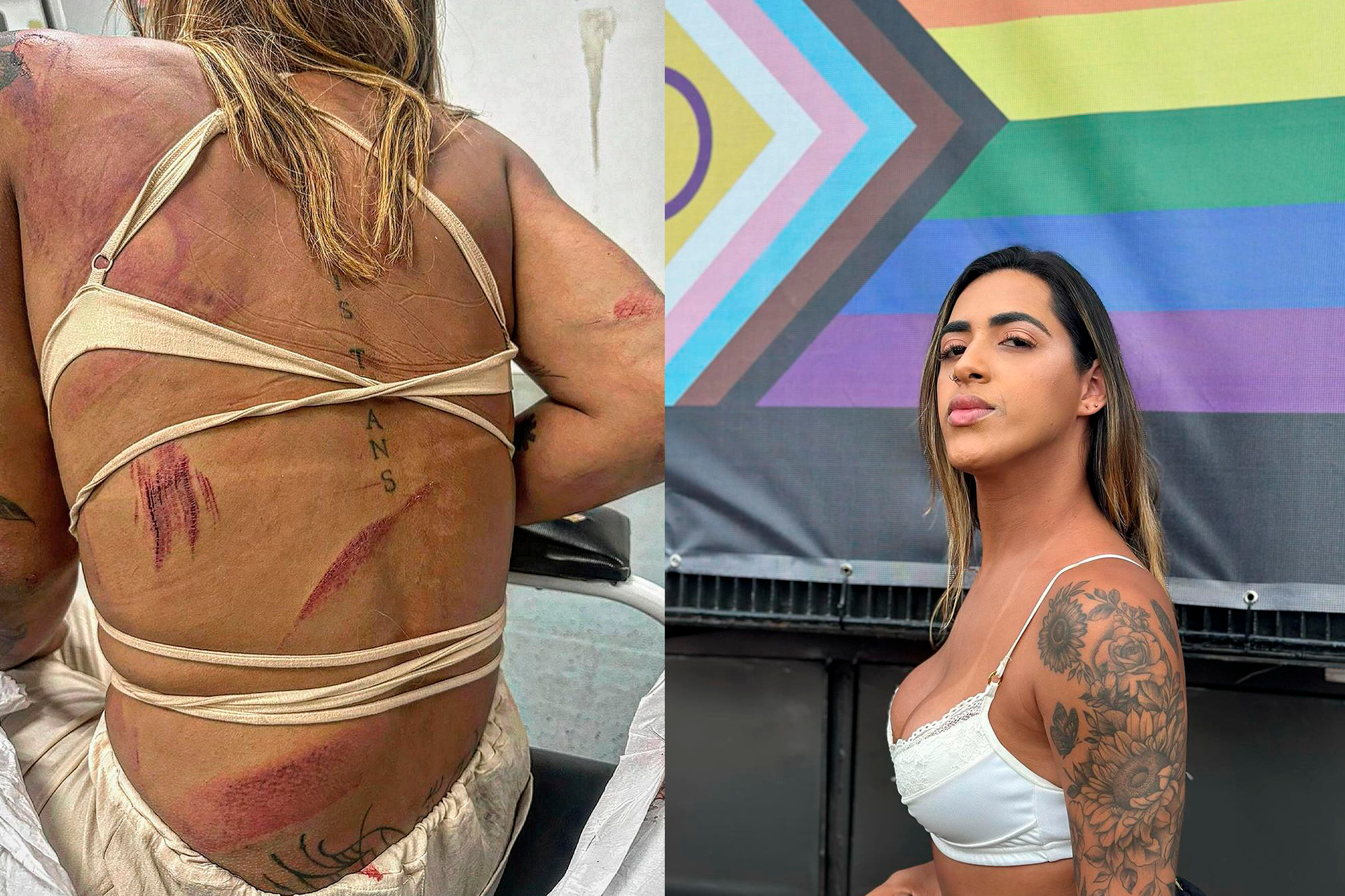 Casal transsexual é agredido em bar no RJ